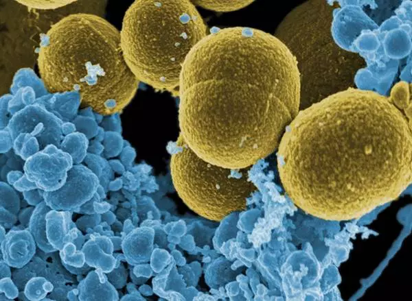 Staphylococcus aureus