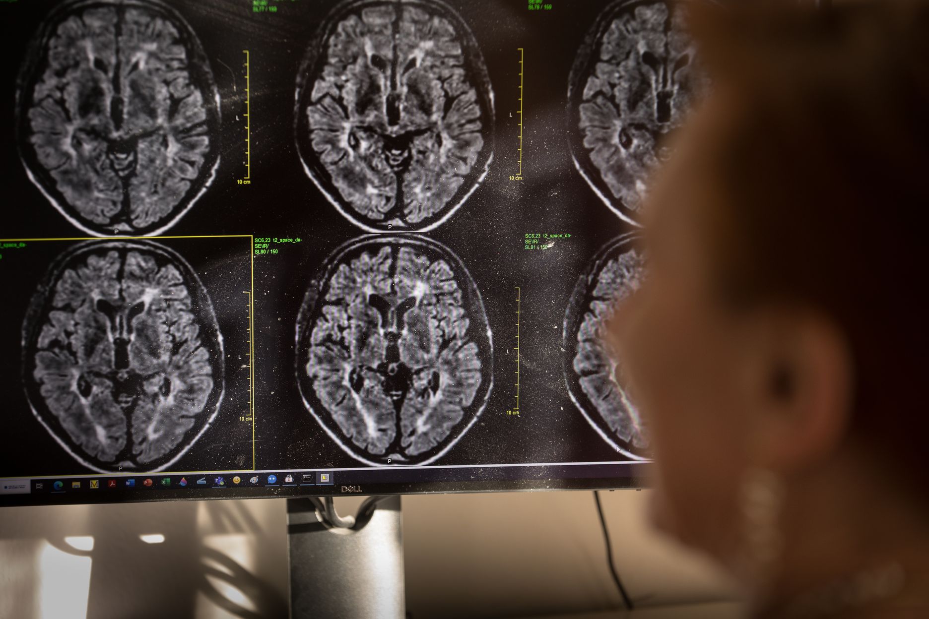 769f7dc9 e190 4703 a08c 9f329cb57c29