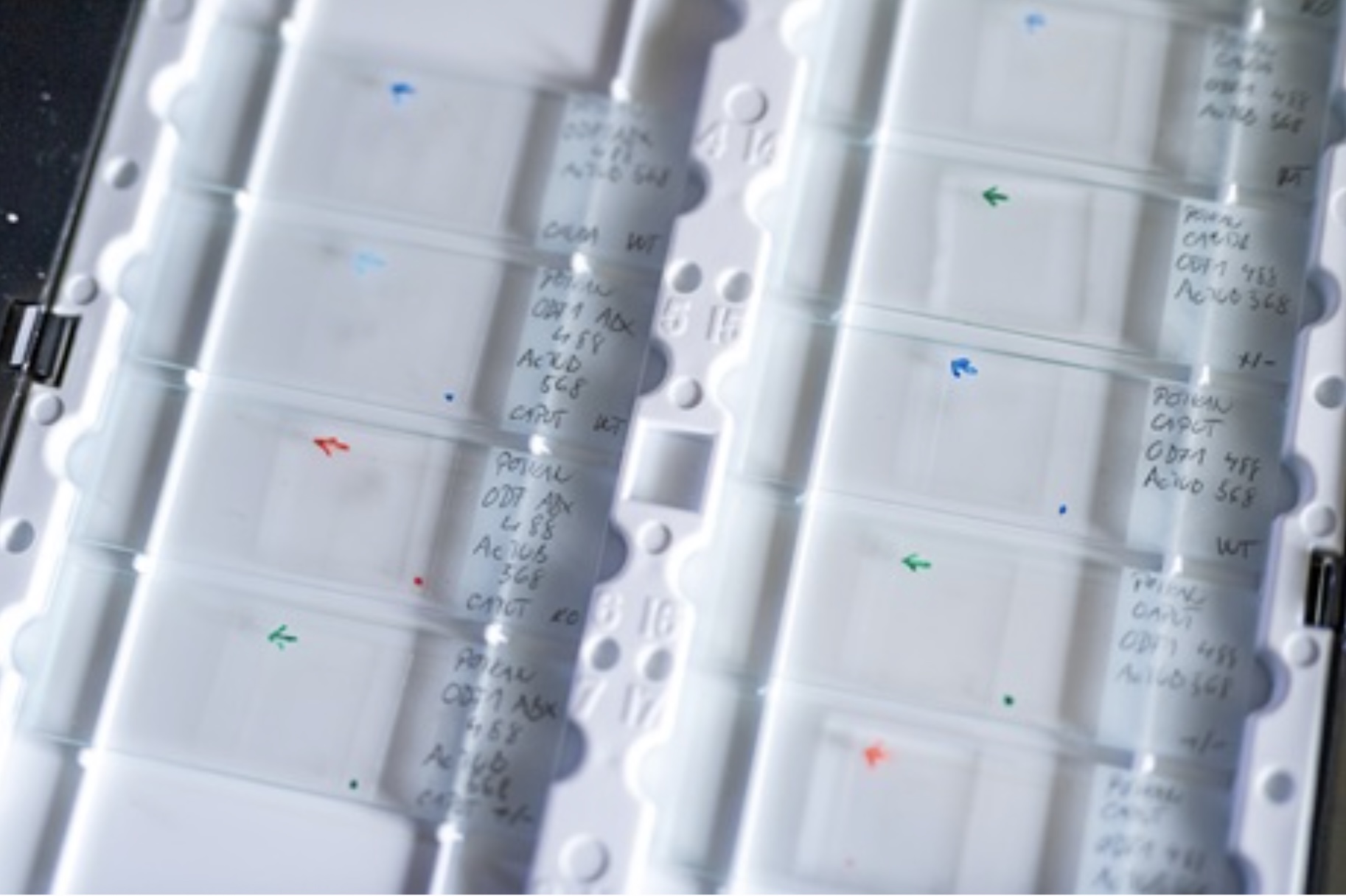 Obrázek ukazuje sadu podložních sklíček s roztěry spermií, které jsou připraveny pro imunofluorescenční analýzu AVCR spermie3