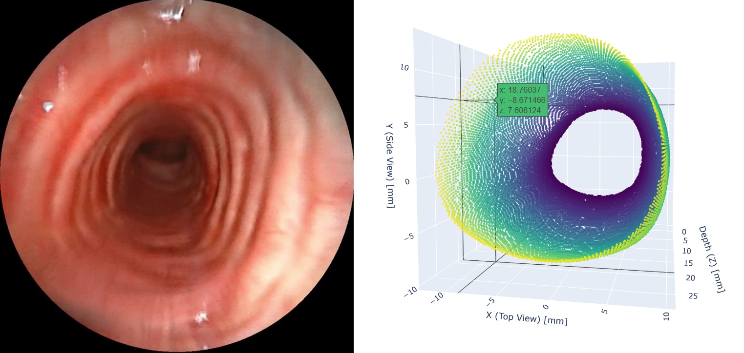 Využití metod počítačového vidění a strojového učení pro zobrazení a měření dýchacích cest