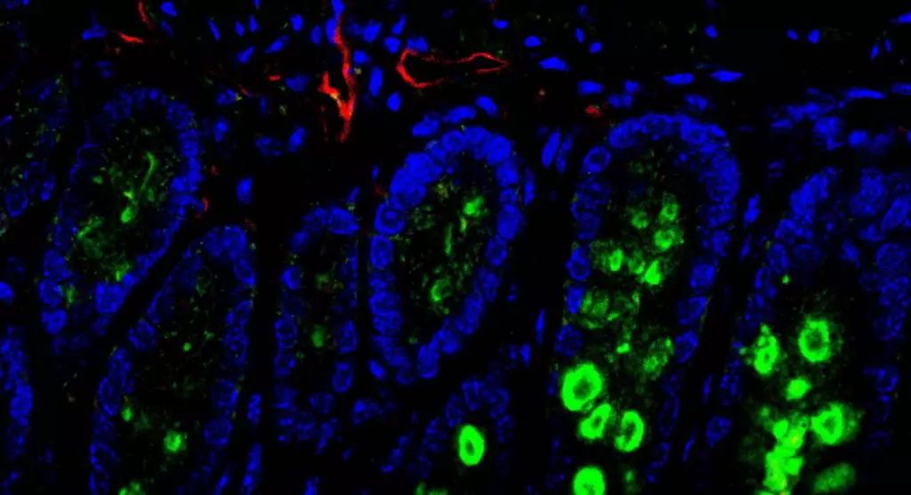 colon immuno