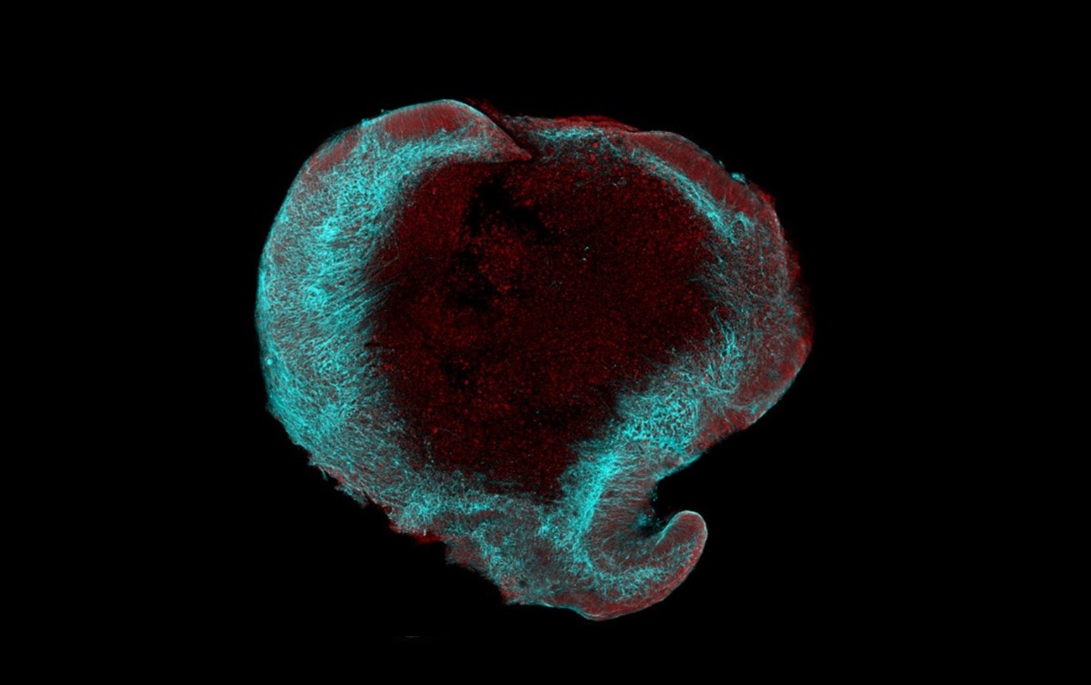 20230626mikroskopicky snimek mozkoveho organoidu