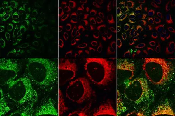 Taxol in cancer cells