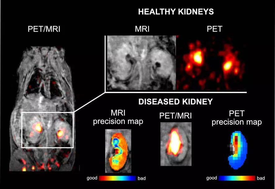 UOCHB PET MRI