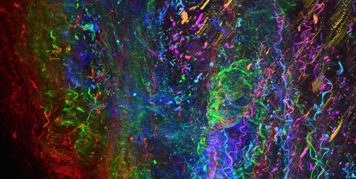 Vzorek extracelulárního matrixu získaného od pacienta zobrazující zdravá kolagenová vlákna. Snímek pořízený dvoufotonovým mikroskopem na ICRC. SoraiaFernandes 2matrix