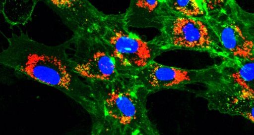 Internalizace (proces, při kterém buňka pohlcuje nebo vstřebává něco z okolí dovnitř sebe) nanočástic (červená barva) fibroblasty spojenými s nádorem. Jádra buněk jsou zobrazená modře, buněčná membrána zeleně. Snímky byly pořízené konfokálním mikroskopem na University of Melbourne soraia4 internalizace