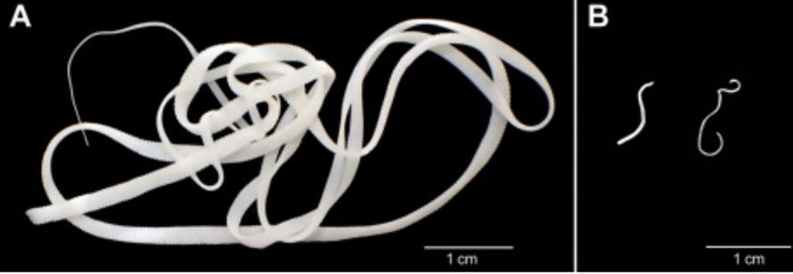 Tasemnice je v dobré kondici, pokud je ve stravě hostitele velký podíl vlákniny (A). Při jejím nedostatku zůstává parazit několikanásobně menší a přechází do úsporného režimu připomínajícího hibernaci (B) tasemnice