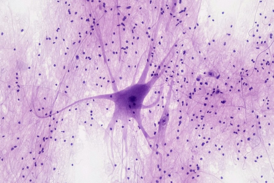 od-octomilek-po-cloudova-reseni-kam-se-posouva-neuroveda