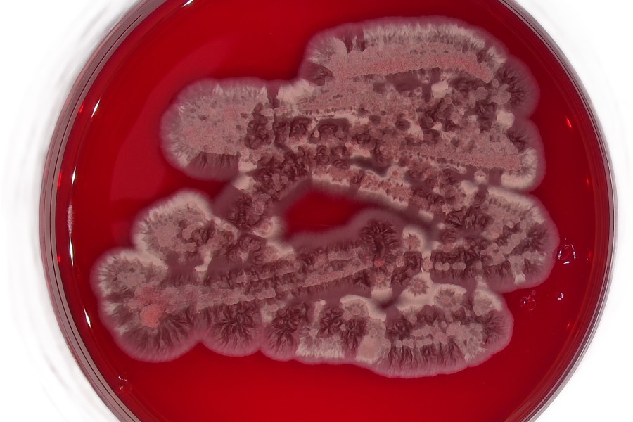 Houba Exobasidium v kultuře roste jako kvasinka produkující výrazně červené pigmenty – gunaciny. | Zdroj: MBÚ AV ČR