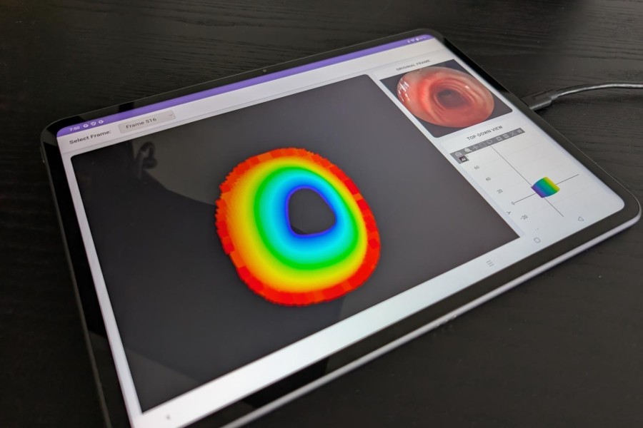 Spolupráce FIT VUT a FN Brno přináší důležité metody do medicínské praxe