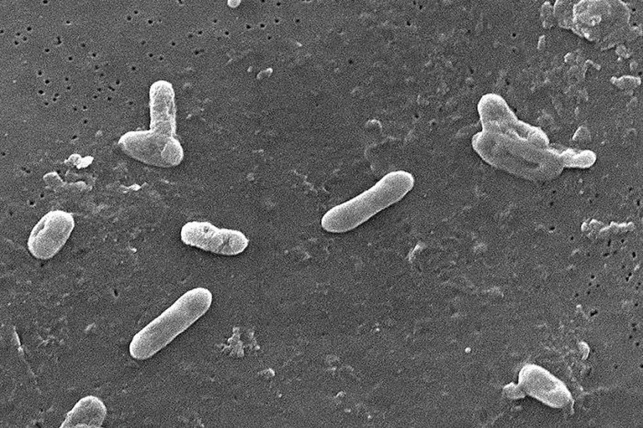 Bordetella bronchiseptica pod rastrovacím elektronovým mikroskopem