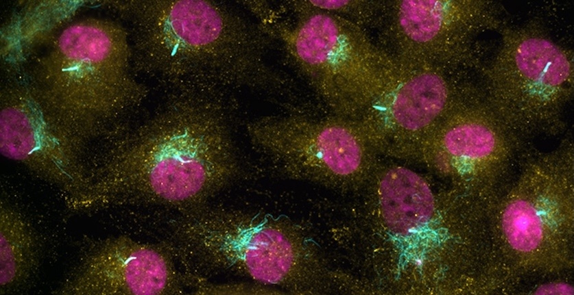 Imunofluorescenční zobrazení buněk RPE1. Acetylovaný tubulin označující primární cilie (cyan), ubiquitin K63 (žlutá) a buněčná jádra (magenta).