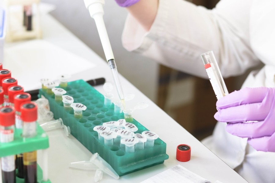 kdo-si-letos-zaslouzi-nobelovu-cenu-za-fyziologii-a-medicinu-cesti-vedci-sazi-na-terapii-diabetu