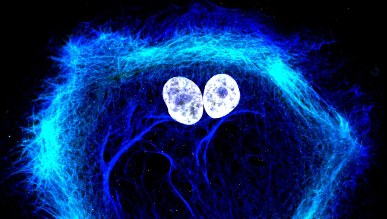 Buňky rakoviny prostaty. Jádra buněk jsou zobrazeny bíle, cytoskelet modře. Snímek byl pořízen konfokální mikroskopií v ICRC SoraiaFernandes prostata